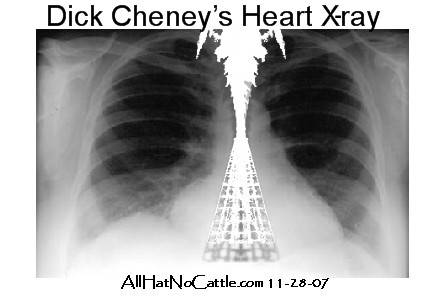 Dick Cheney Heart. Dick Cheney's Heart Xray - All